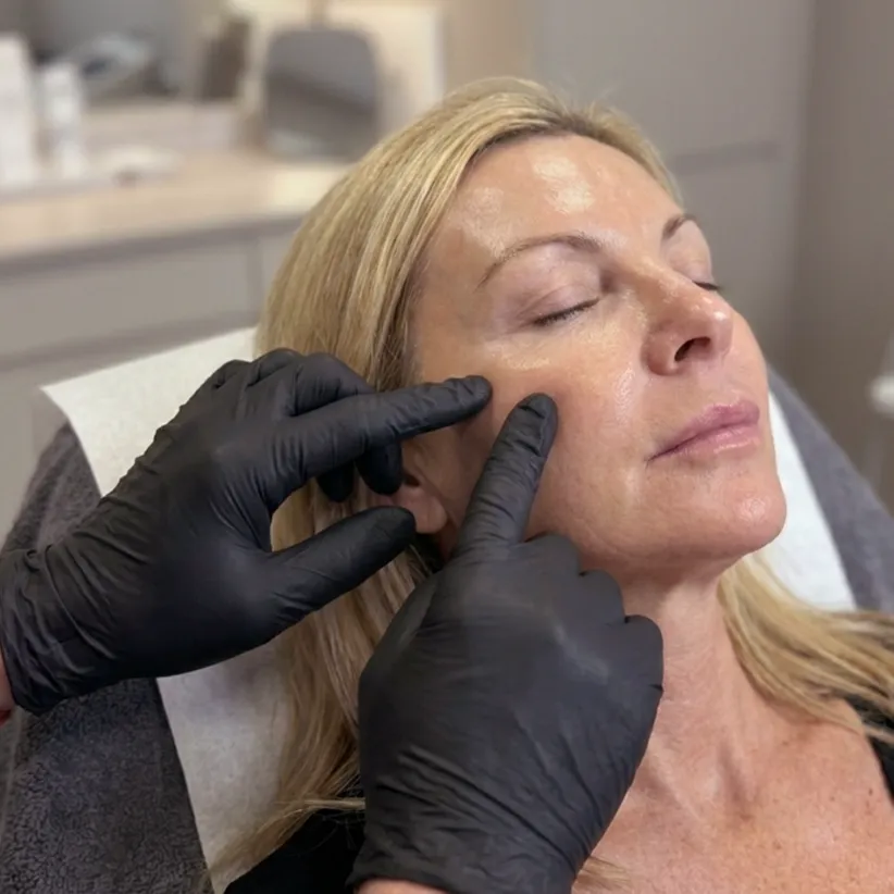 Seventy Hyal skin booster consultation